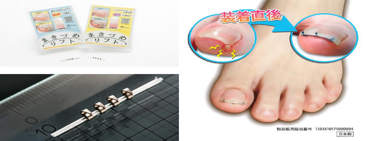Medical Device Precision Metal Stamping